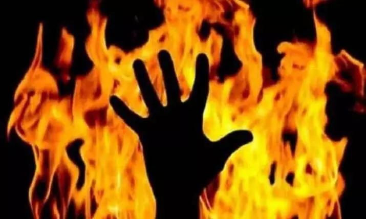 Dalit girl set ablaze by jilted lover in UP