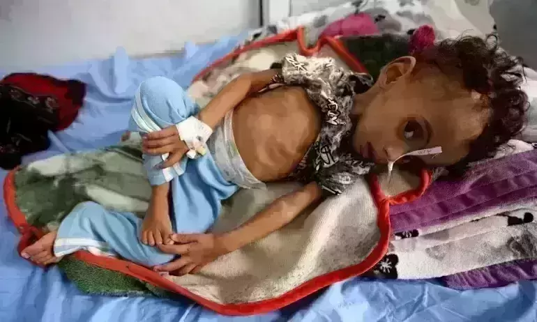 Countdown to catastrophe in Yemen; UN warns of extreme poverty