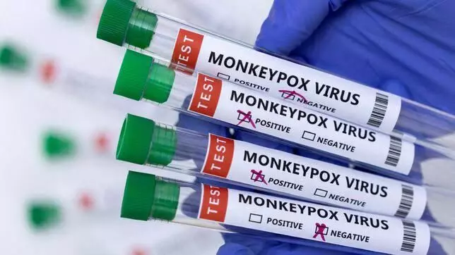 780 monkeypox outbreak cases reported from 27 countries as of June 2: WHO