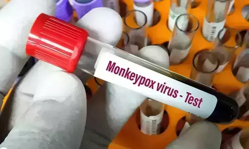Monkey pox demands extreme caution