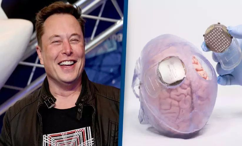 Neuralinks brain implant all set for human trials, says Musk