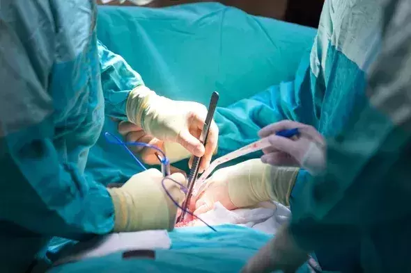 Brain-dead womans hands donated for transplantation in Madhya Pradesh