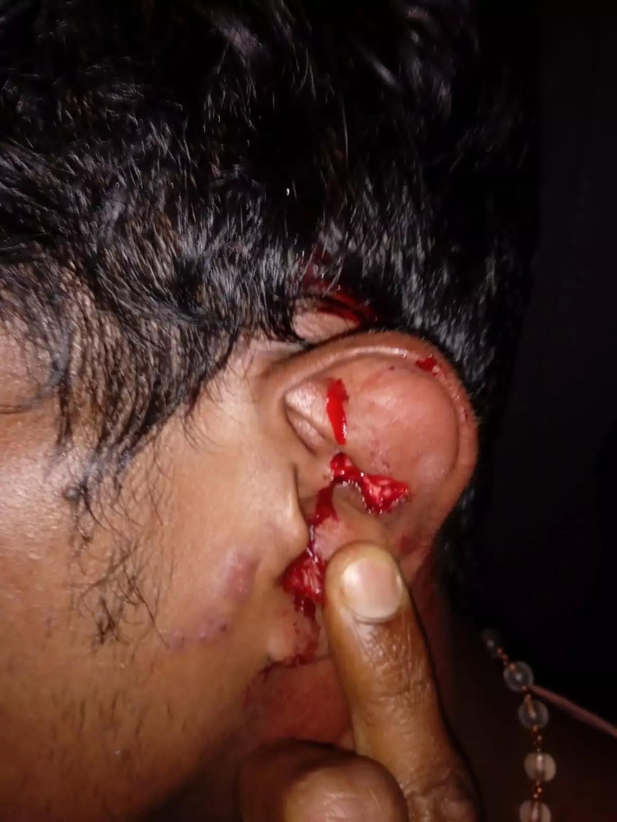  A native of Tamil Nadu had his ear ripped off in the beating