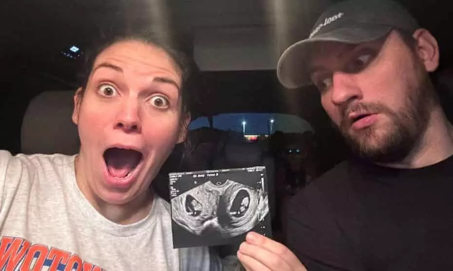 In rare medical event, woman with two uteruses is pregnant in both wombs