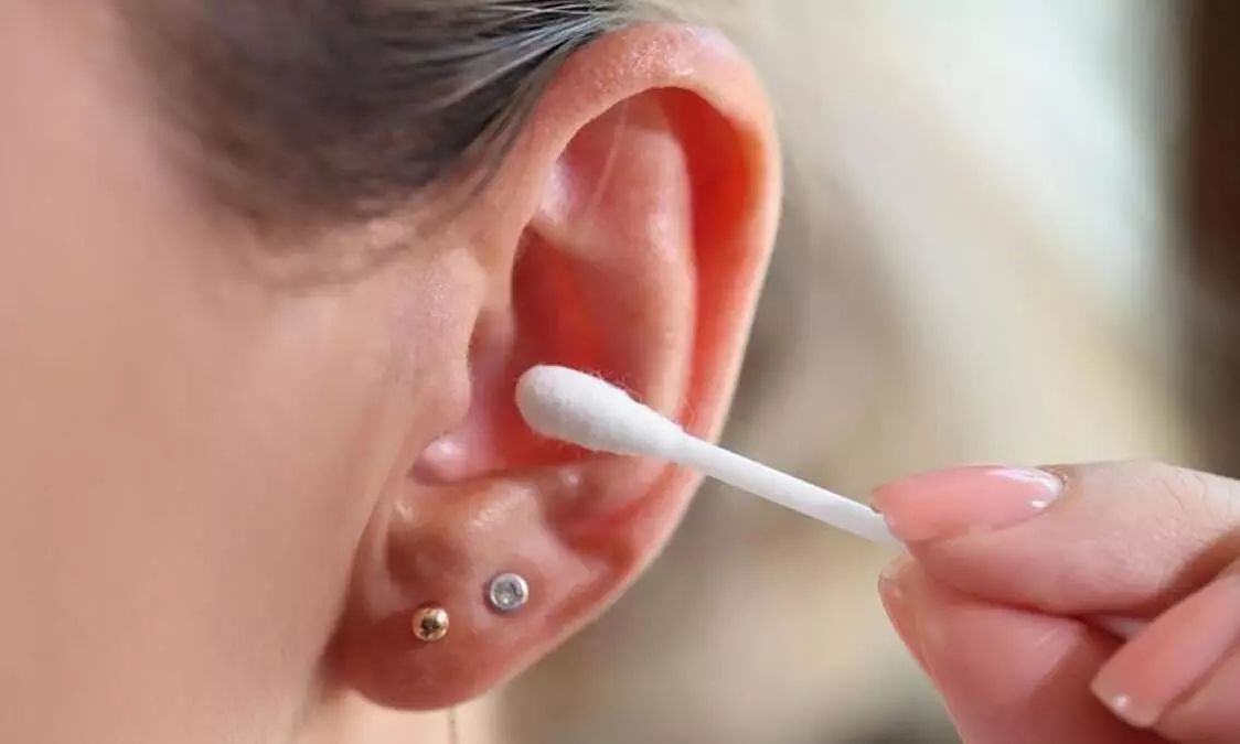 DIY ear wax removal could lead to hearing loss, warns experts
